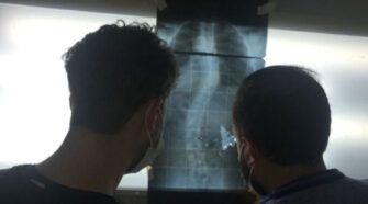 Escoliosis concientización